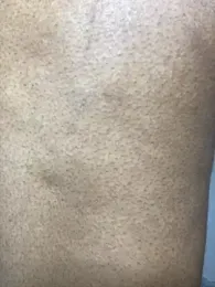 incognitobdy webcam model stream image